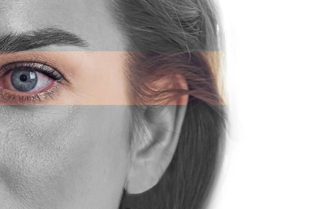 A close-up view of a woman's visibly dry eye. Meibomian gland blockages can result as a symptom of dry eye and meibomian gland dysfunction.